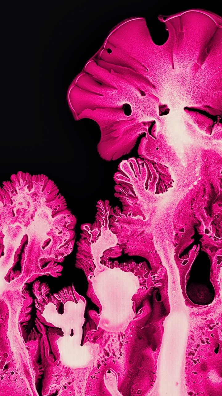 Download wallpaper 720x1280 pink coral, ink art, pattern, macro ...
