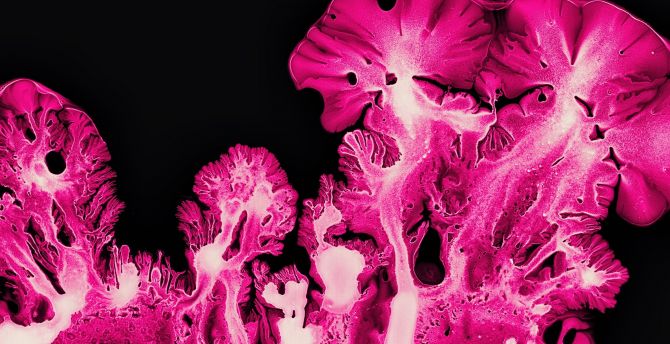 Pink coral, ink art, pattern, macro wallpaper